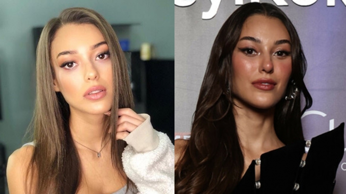 Dilan Çiçek Deniz estetik operasyon mu yaptırdı, Dilan Çiçek Deniz’in yüzüne ne oldu?
