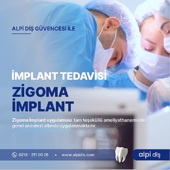 ALPİ DİŞ Hastanelerinde Zigoma İmplant Tedavisi