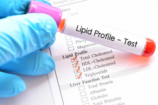 Lipid Profili Nedir?